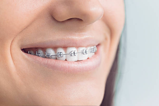 Best Crowns and Bridges  in Irving, TX